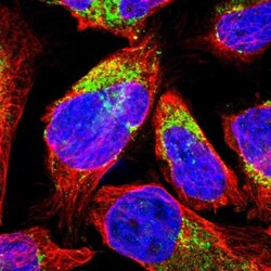 MCCC1 Antibody, Novus Biologicals 25 &mu;L; Unlabeled:Antibodies, Polyclonal